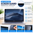 HD Clear PET Screen Protector for MacBook Pro 16" 2019 A2141 | Clear MacBook Screen Guard | Anti-Scratch Laptop Display Protector | iCare